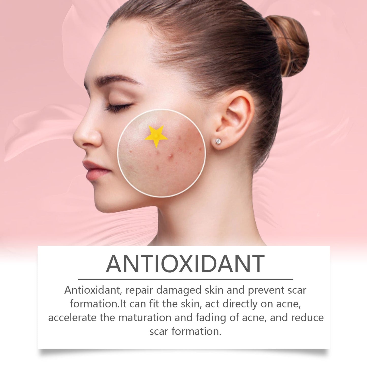 Repair Acne Patch, Facial Cleansing Cover Acne Skin Moisturizing Gentle Skin Cream - Korvel
