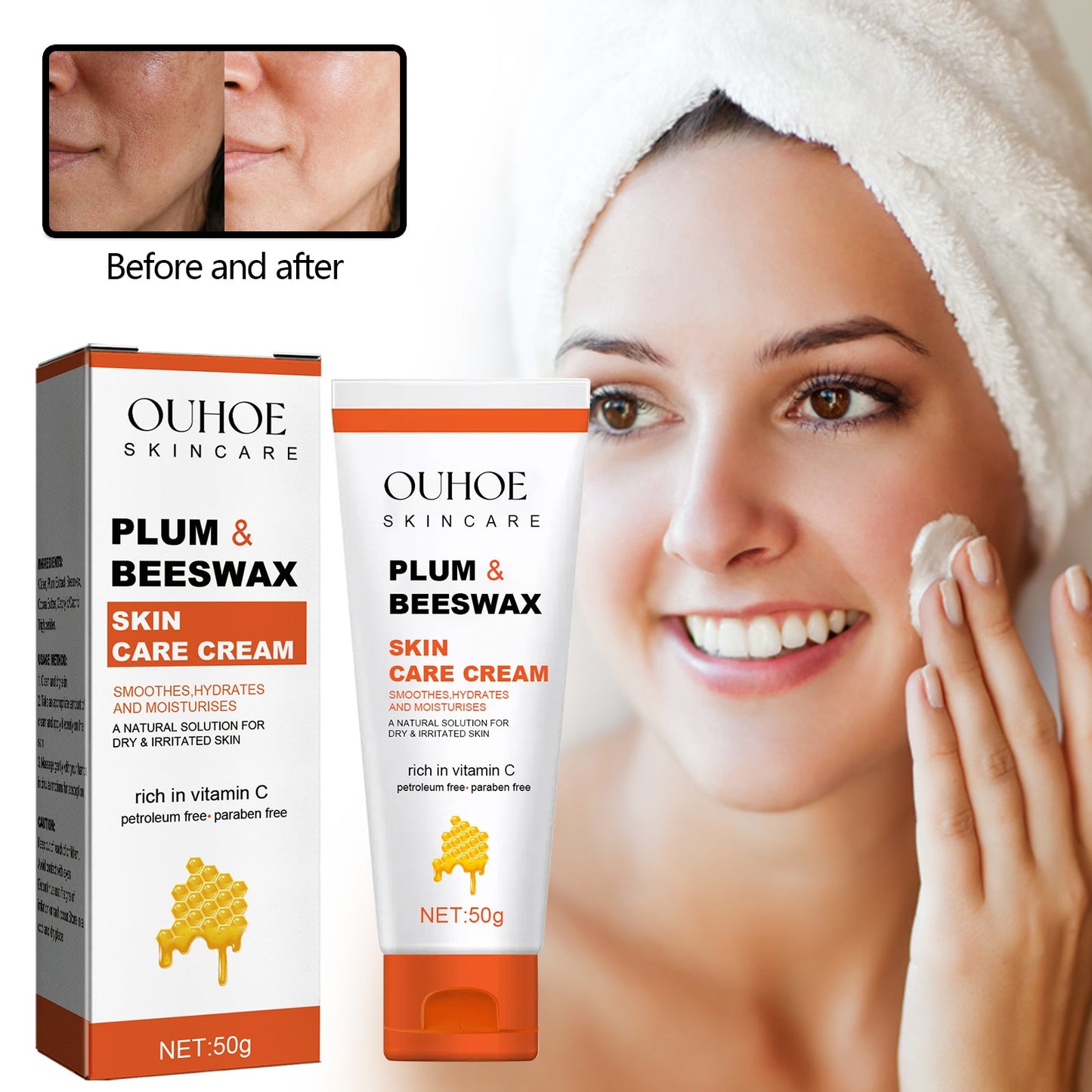Beeswax Skin Cream Moisturizes Skin, Relieves Dry Skin, Sunburn, Mosquito Bites And Itch Relief Cream - Korvel