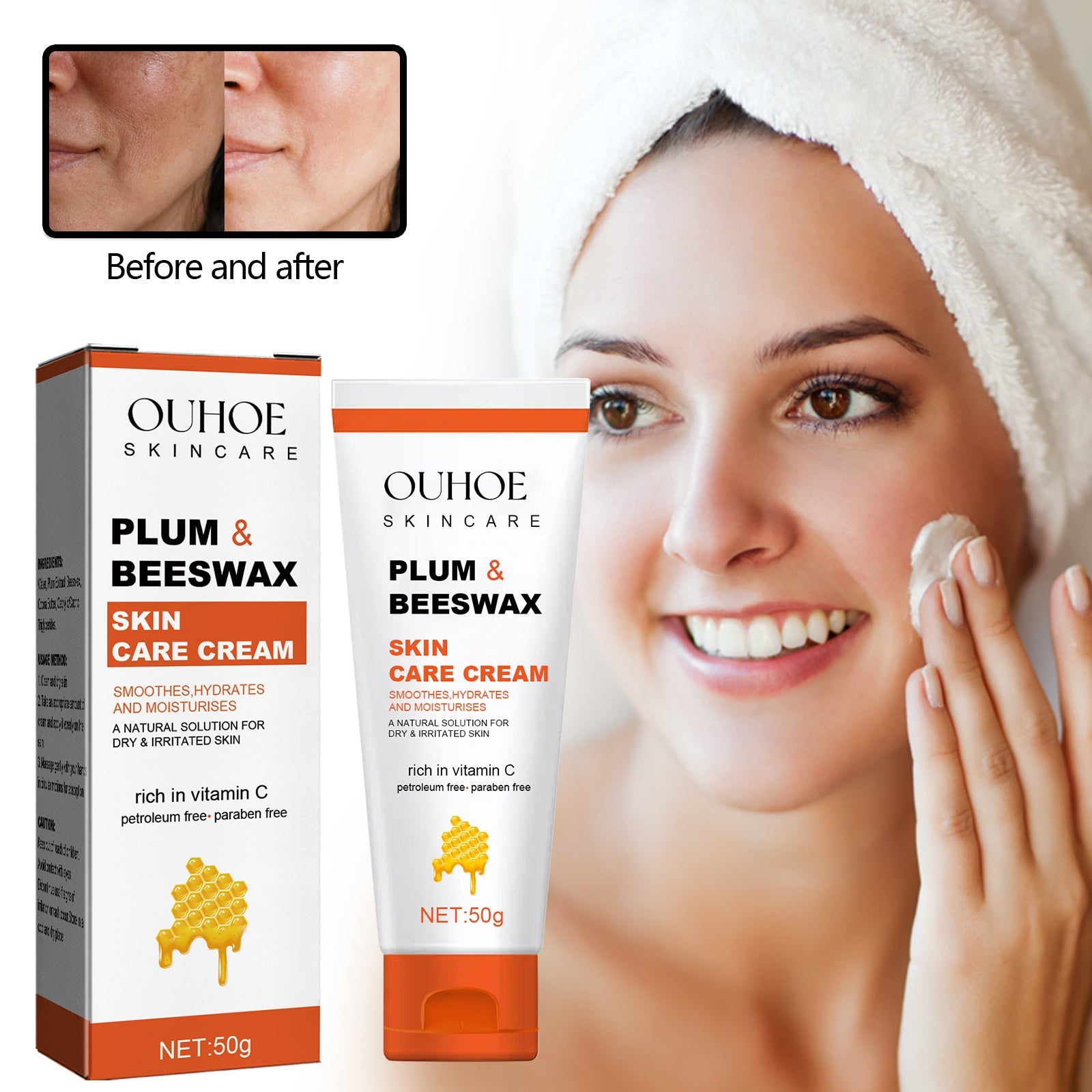 Beeswax Skin Cream Moisturizes Skin, Relieves Dry Skin, Sunburn, Mosquito Bites And Itch Relief Cream - Korvel