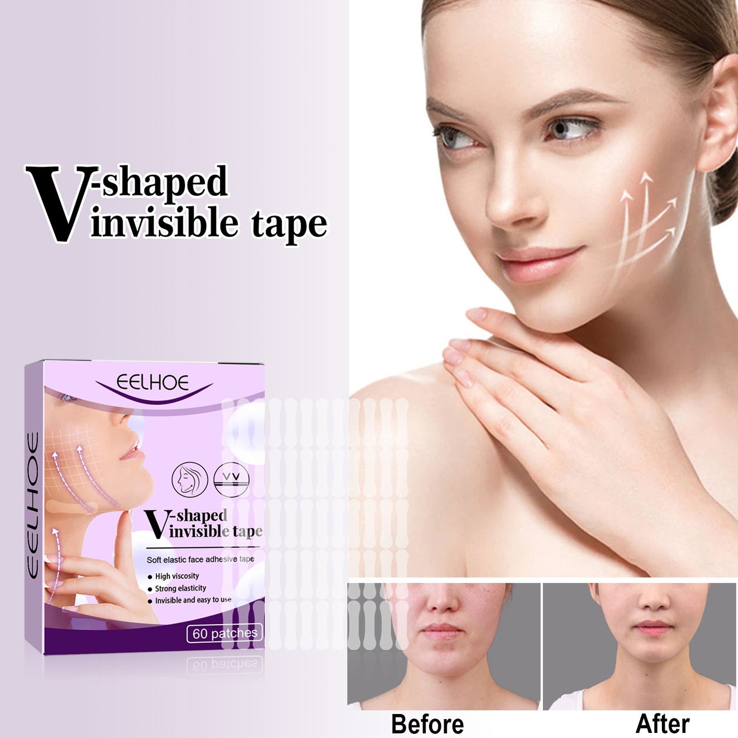 Invisible Lifting Patch for a Defined V-Face
