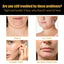 Mascarilla Facial Reafirmante en Forma de V
