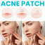 Invisible Acne Repair Patch - Hydrocolloid Concealer
