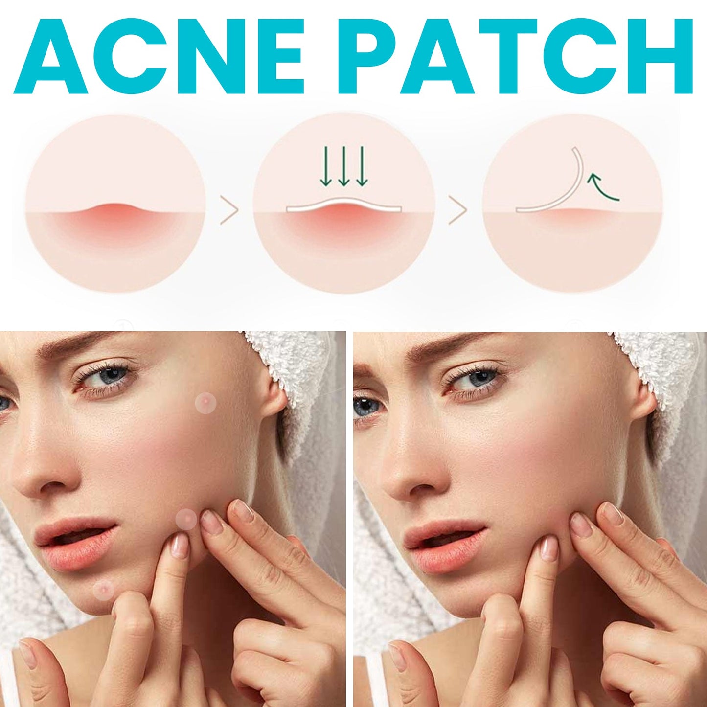 Invisible Acne Repair Patch - Hydrocolloid Concealer