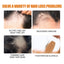 Premium Hair Growth Spray for Men - Thickening & Strengthening