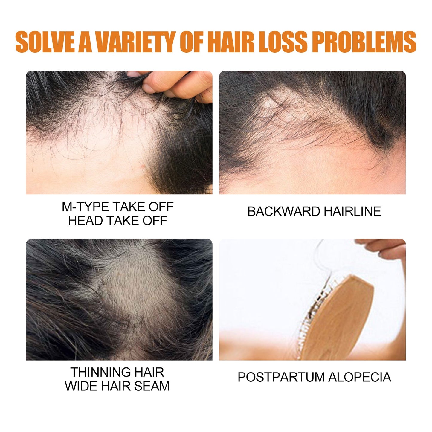 Premium Hair Growth Spray for Men - Thickening & Strengthening