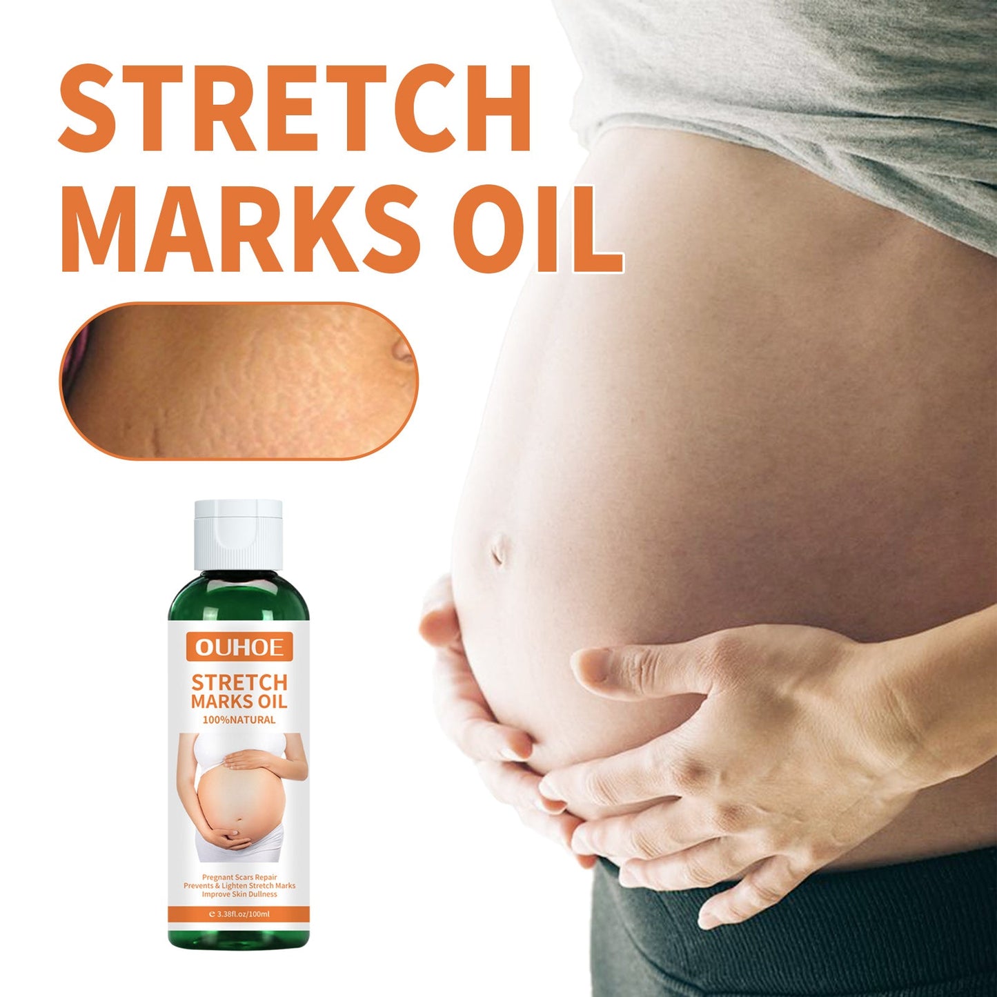 Pregnancy Massage Oil, Repair Pregnant Women Prenatal And Postpartum Stretch Mark Skin Care Massage Oil - Korvel