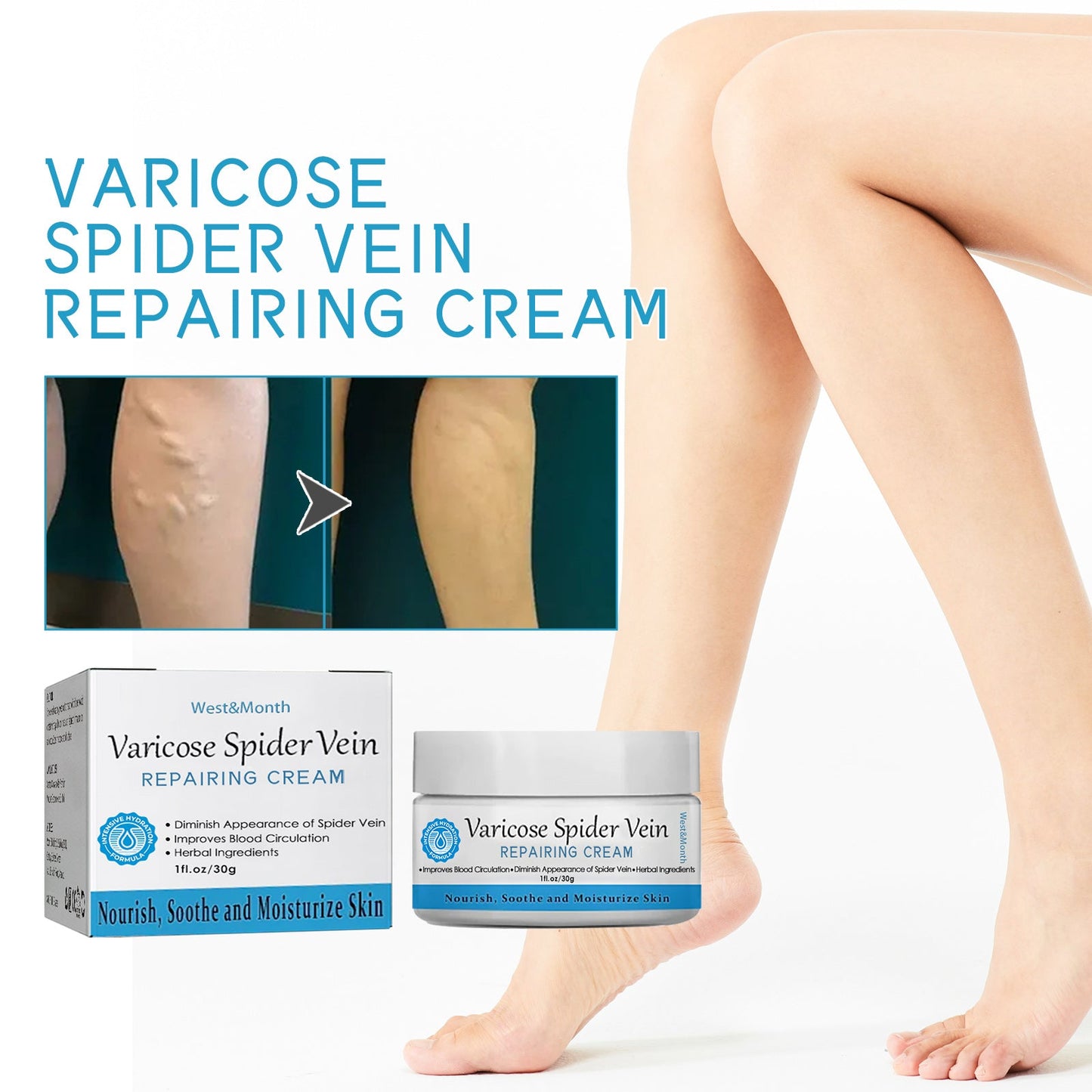 Varicose Spider Vein Repairing Cream, Relief Leg Pain Earthworm Leg Veins Care Massage Cream - Korvel