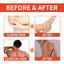 Bee Venom Patch, Relieve Hand-Foot Flexure Joint Shoulder Neck Lumbar Knee Soreness Care Body Patch - Korvel