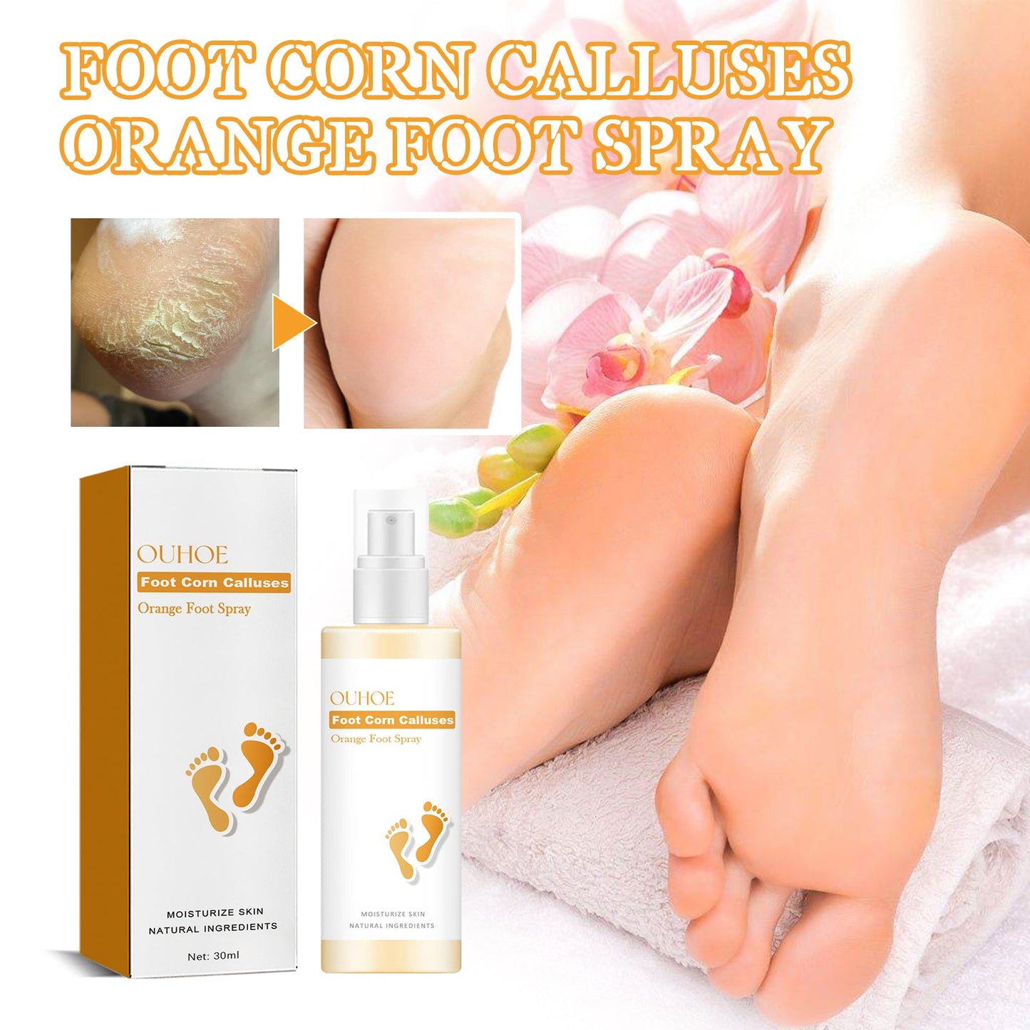 Moisturizing Foot Spray for Callus Care