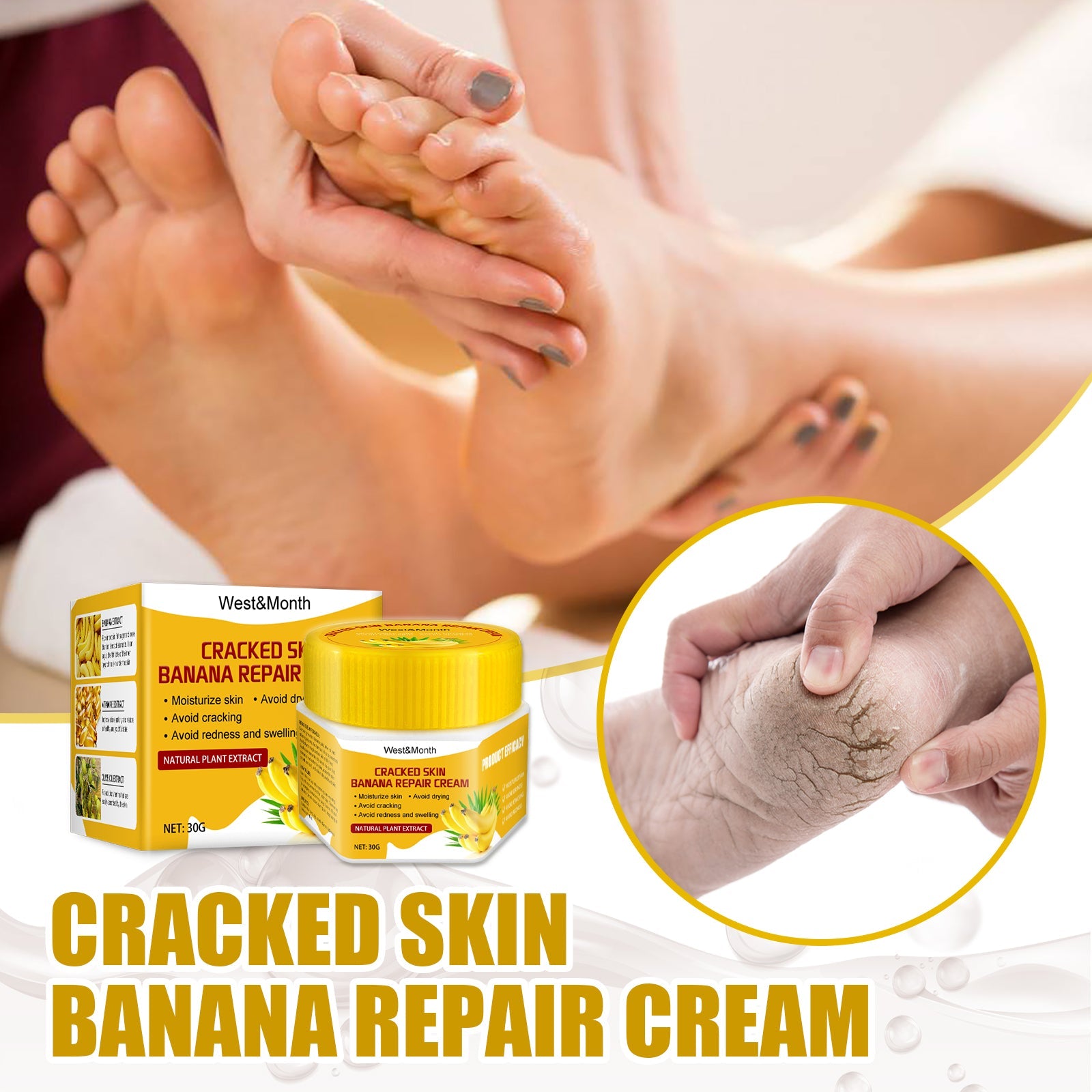 Cracked Skin Banana Repair Cream, Nourishing And Moisturizing Foot Repair Cream To Soften Exfoliation And Remove Dead Skin Calluses - Korvel