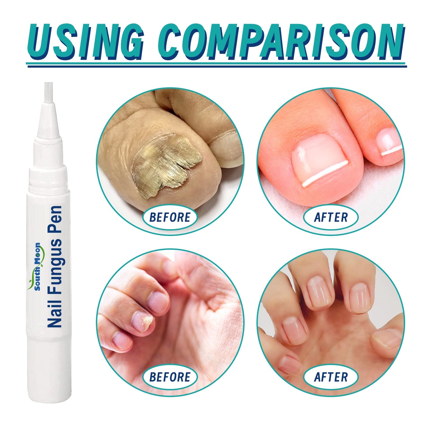 Stylo de Réparation des Ongles pour un Soin Amélioré des Ongles