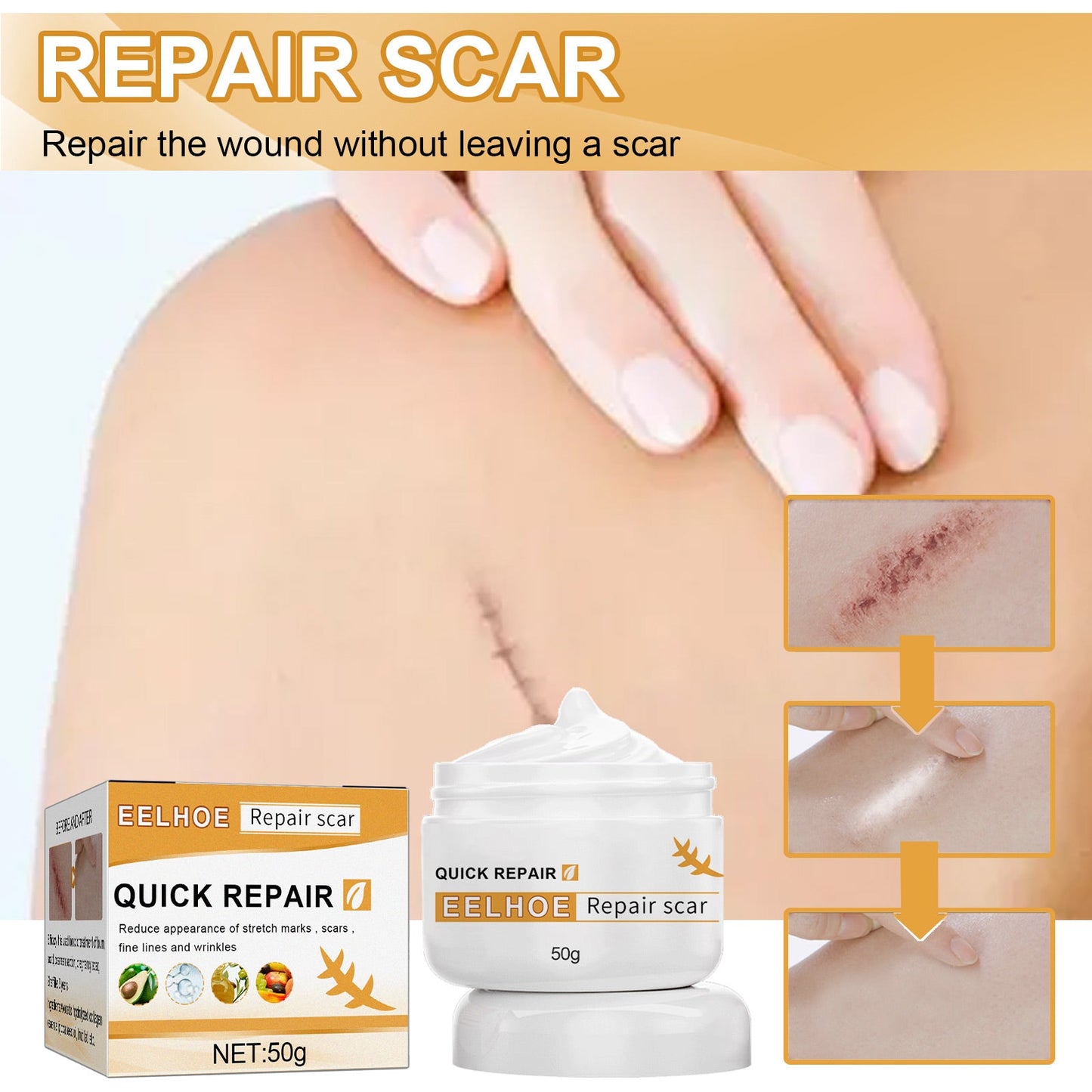 Crème Réparatrice de Peau Premium pour Cicatrices et Brûlures