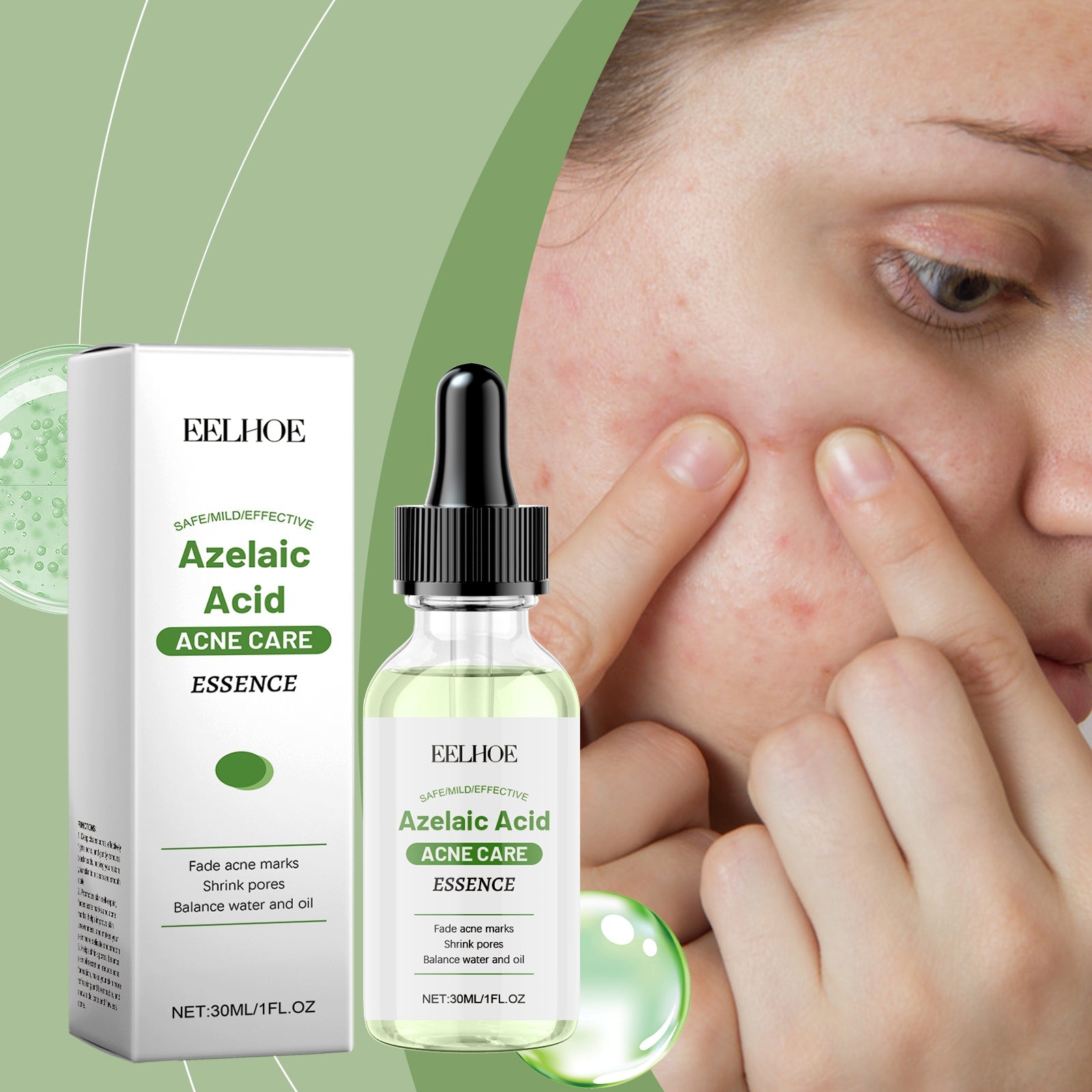 Azelaic Acid Facial Essence Moisturizes And Improves The Skin For Blackheads And Acne - Korvel
