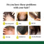 Spray para el cabello con jengibre para fortalecer y nutrir el cabello
