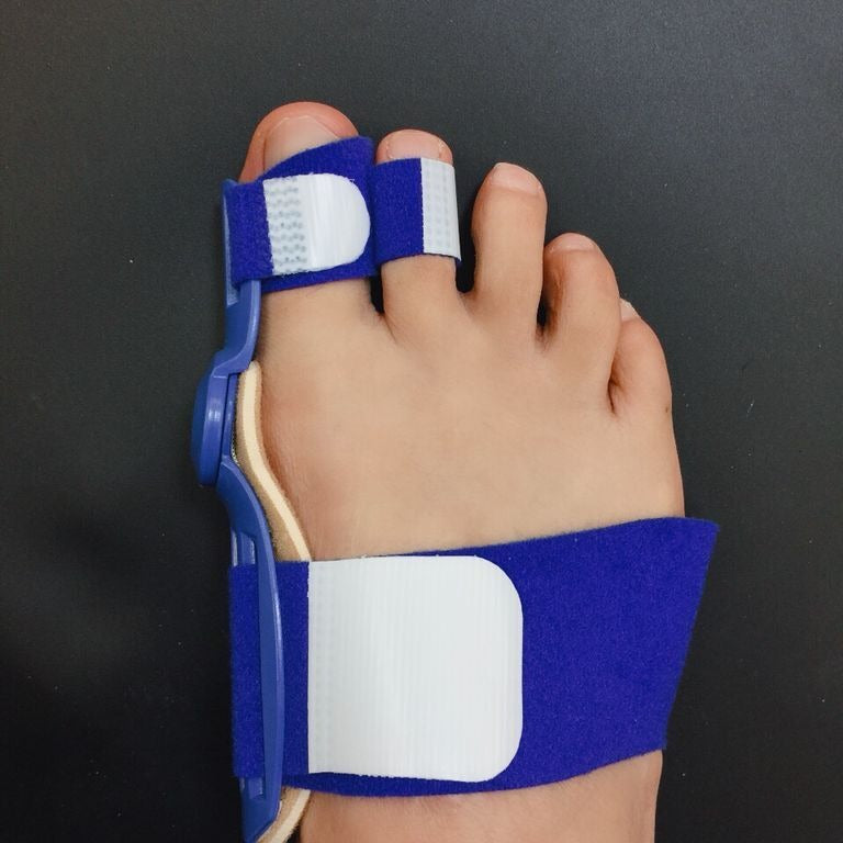Day And Night Use Of Hallux Valgus Orthosis Thumb Valgus Orthosis Toe Orthosis - Korvel
