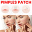 Jaysuing Repair Acne Patch for Clear Skin