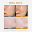 Mascarilla Facial Hidratante - Set de 5