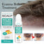 Scalp Care Ball, Repair Skin Moss Scalp Moss Deep Clean And Moisturizing Scalp Care Ball - Korvel