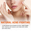 Salicylic Acid Facial Mask Gentle Cleansing Mask To Lighten Acne, Seal And Tighten Pores - Korvel