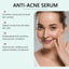 Pore Care Essence, Gently Clean Facial Skin Acne Tender And Smooth Skin Care Essence - Korvel