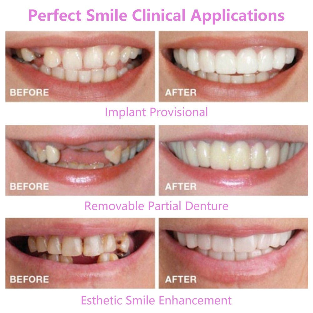 Simulation braces smile whitening sixth generation non-porous teeth set dentures - Korvel