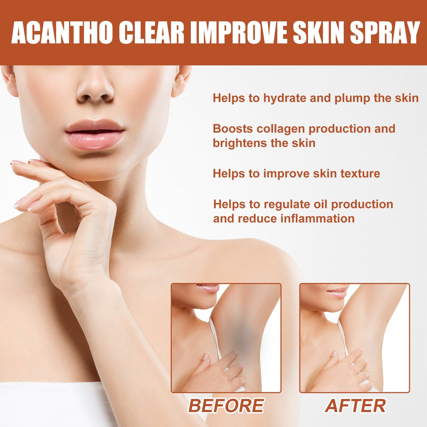 Acantho Clear Improve Skin Spray, Repair Black Spot, Elbow Knee Joint Black Whitening Skin Spray - Korvel