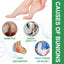 Bunion Relief Patch Corrects Thumb And Foot Joint Valgus And Relieves Swelling And Pain Foot Care Patch - Korvel