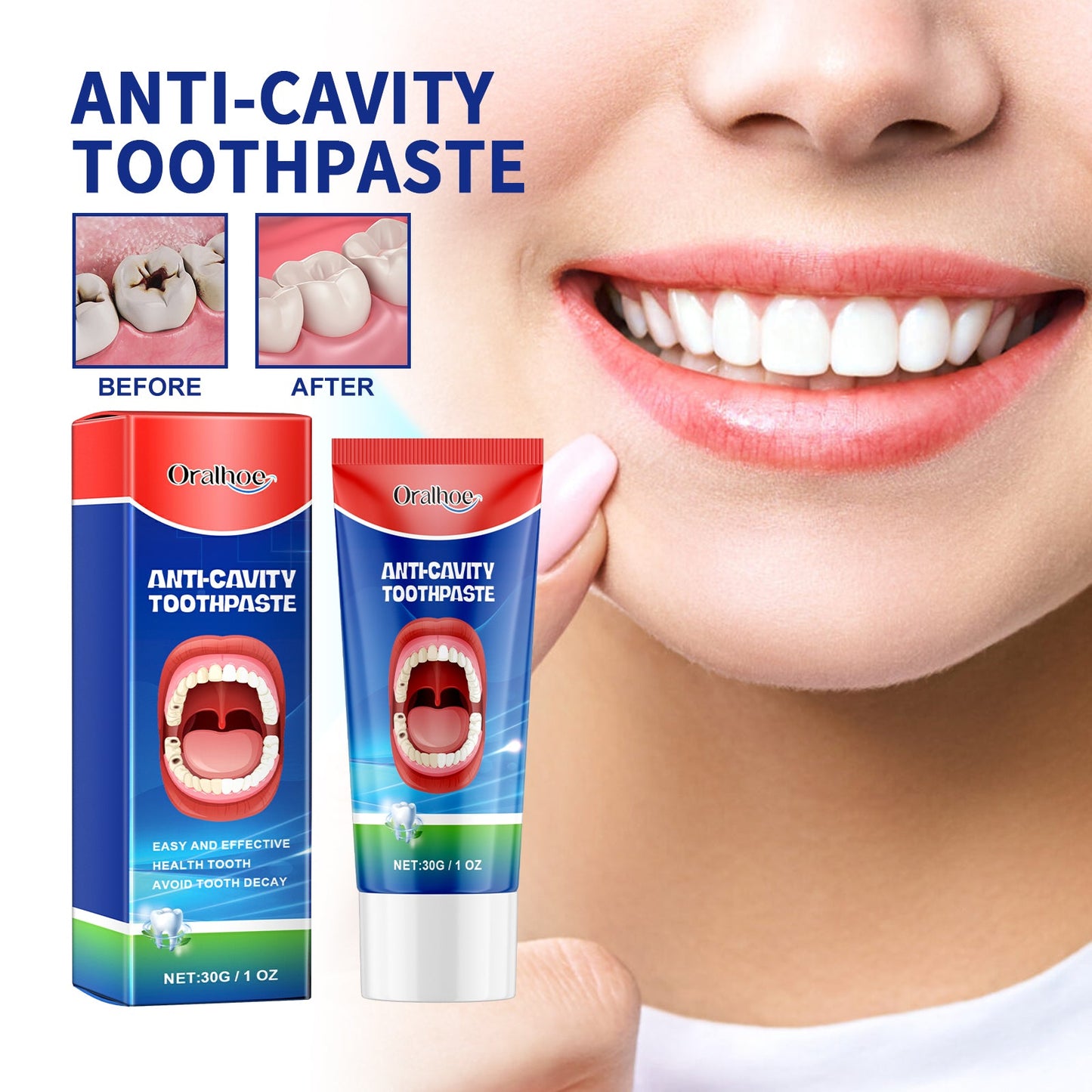 Dentifrice Premium Anti-Caries pour Soin Oral