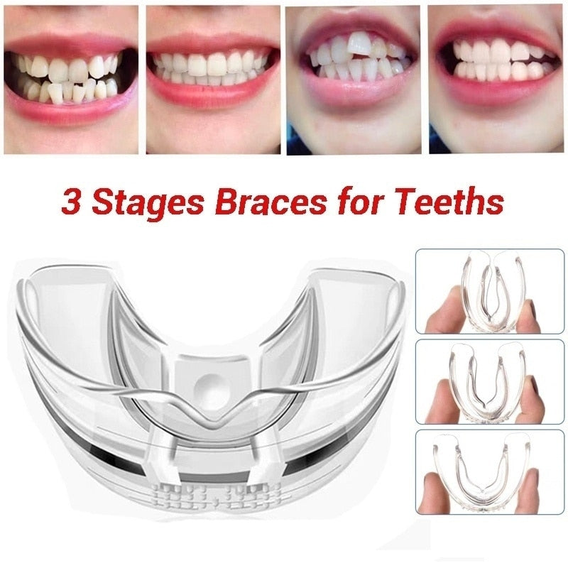 3 Stages Dental Orthodontic Braces Appliance Braces Alignment Trainer Teeth Retainer Bruxism Mouth Guard Teeth Straightener - Korvel