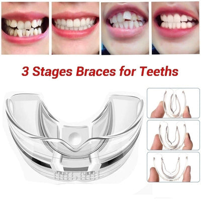 3 Stages Dental Orthodontic Braces Appliance Braces Alignment Trainer Teeth Retainer Bruxism Mouth Guard Teeth Straightener - Korvel