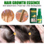 Spray de Croissance Capillaire au Gingembre - Solution Nourrissante pour les Cheveux