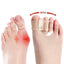 BunionEase Toe Separators - Korvel
