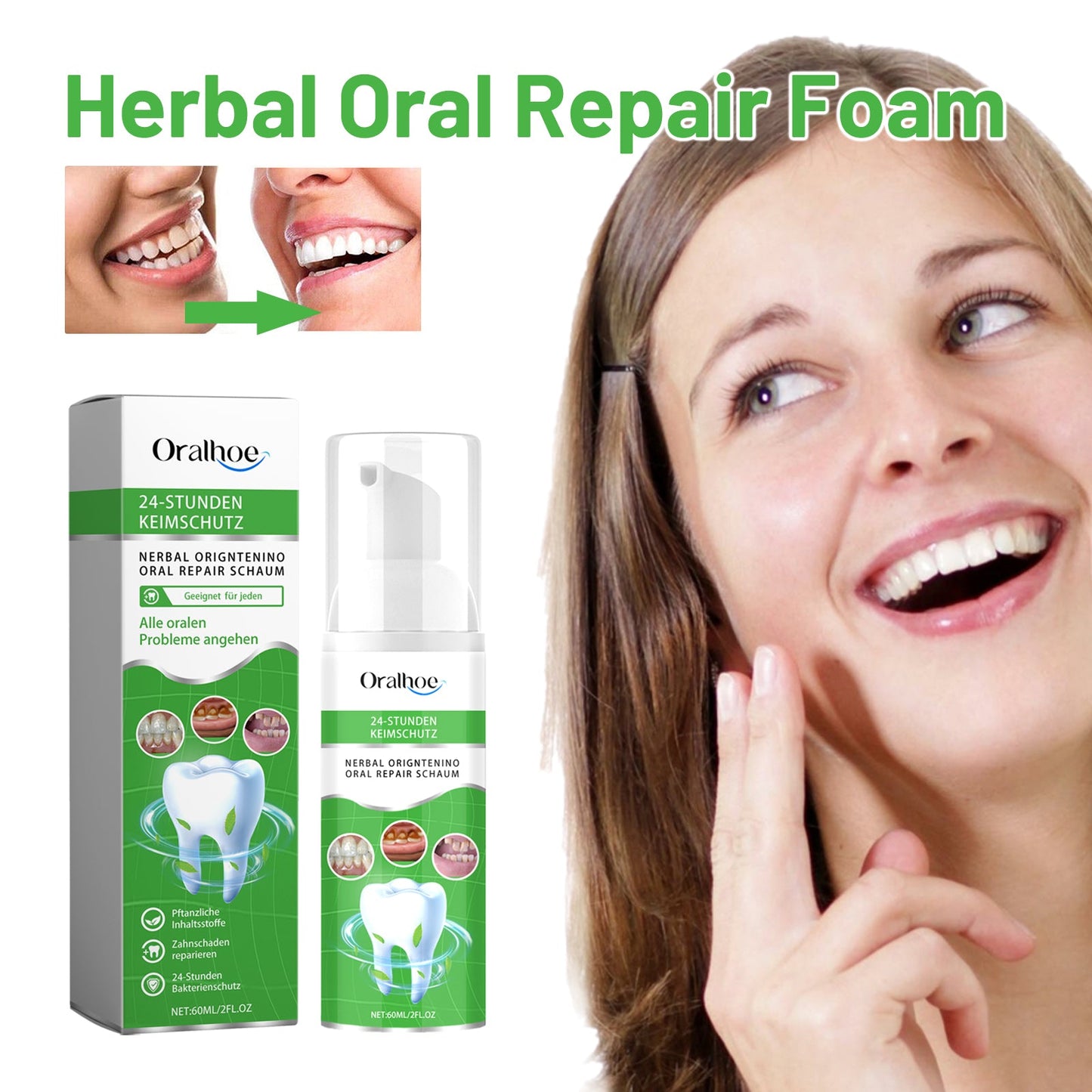 Herbal Oral Repair Foam, Deep Cleaning tartar Stone Fresh Breath Whitening teeth Oral mousse - Korvel