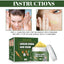 Herbal Acne-Removing Cream Anti-acne-Removing Cream Moisturizing Cleansing Cream Water Oil Balance Anti-acne-Removing Cream - Korvel