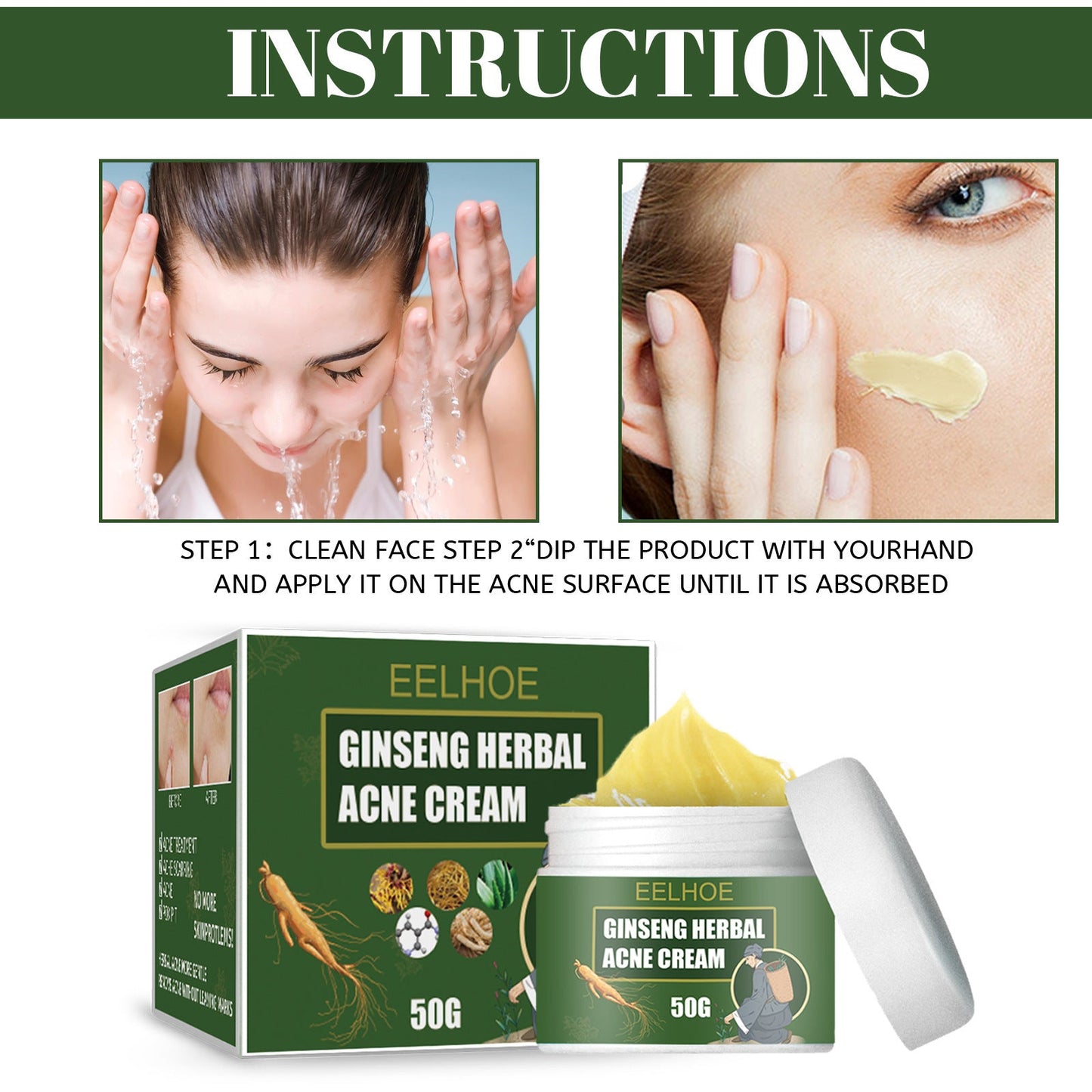 Herbal Acne-Removing Cream Anti-acne-Removing Cream Moisturizing Cleansing Cream Water Oil Balance Anti-acne-Removing Cream - Korvel
