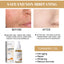 Turmeric Correction Essence Facial Care Hydrating Moisturizing Gentle Moisturizing Skin Care Essence - Korvel