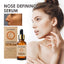 Nose Setting Serum, Nose Firming Massage Nose Straightening And Lifting Nose Bridge Beauty Nose Serum - Korvel