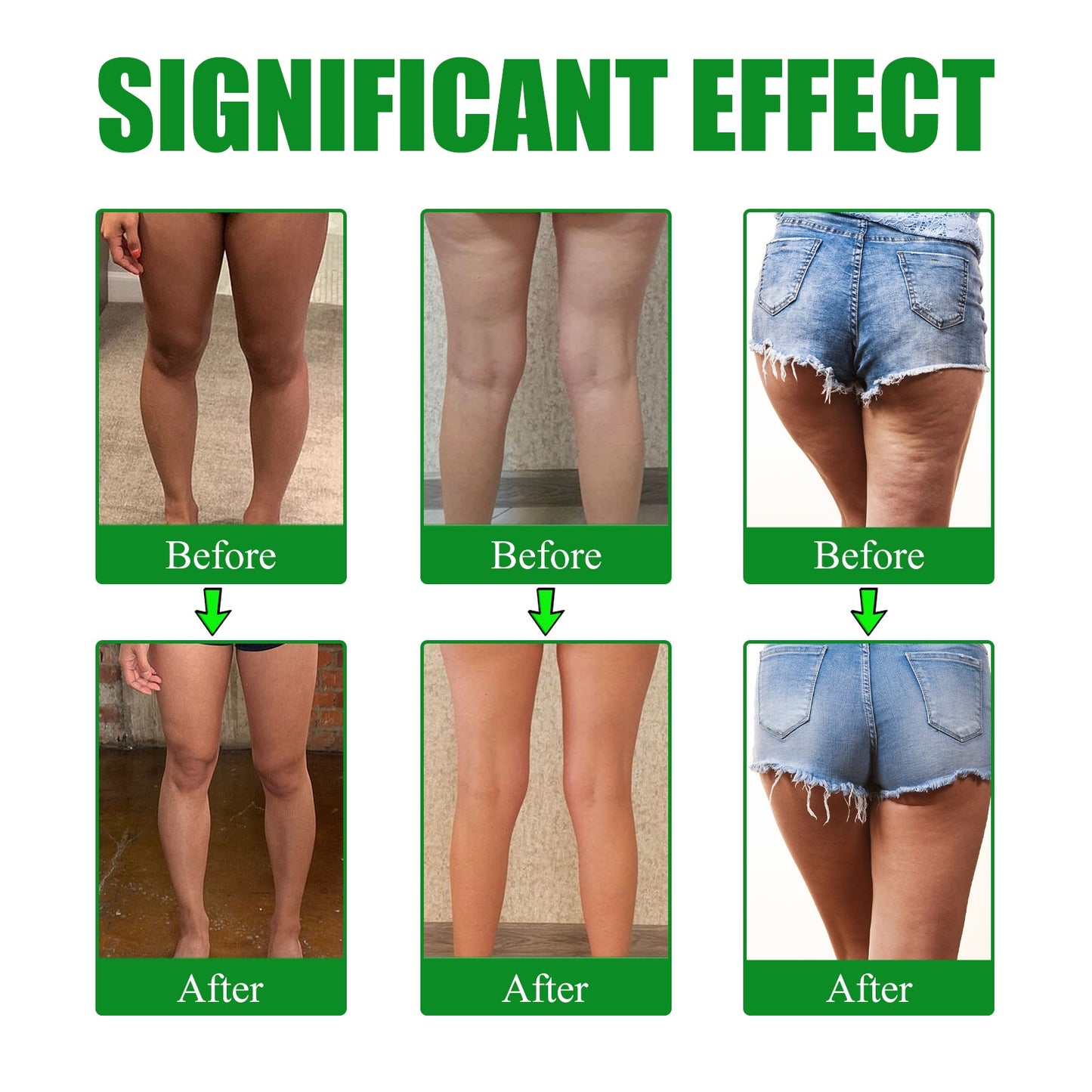 Moxa Leg Lift Paste, Tight Leg Fat, Anti-Orange Peel Shape Lazy People To Create Beautiful Slim Legs - Korvel