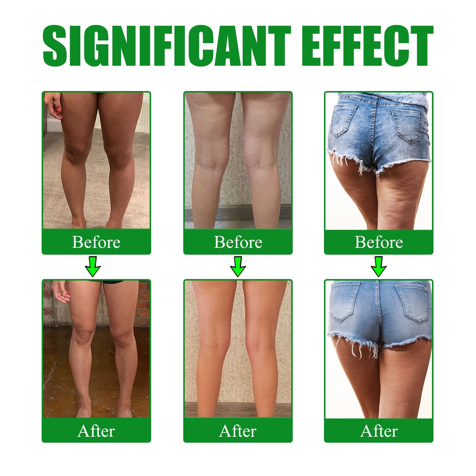 Moxa Leg Lift Paste, Tight Leg Fat, Anti-Orange Peel Shape Lazy People To Create Beautiful Slim Legs - Korvel