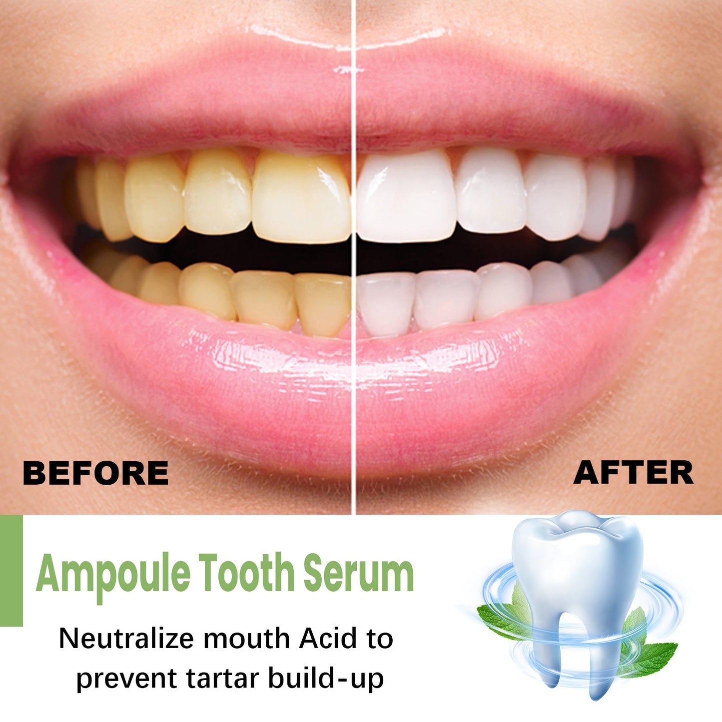 Teeth Whitening Serum To Remove Stains, Bad Breath, Whitening Teeth And Whitening Teeth - Korvel