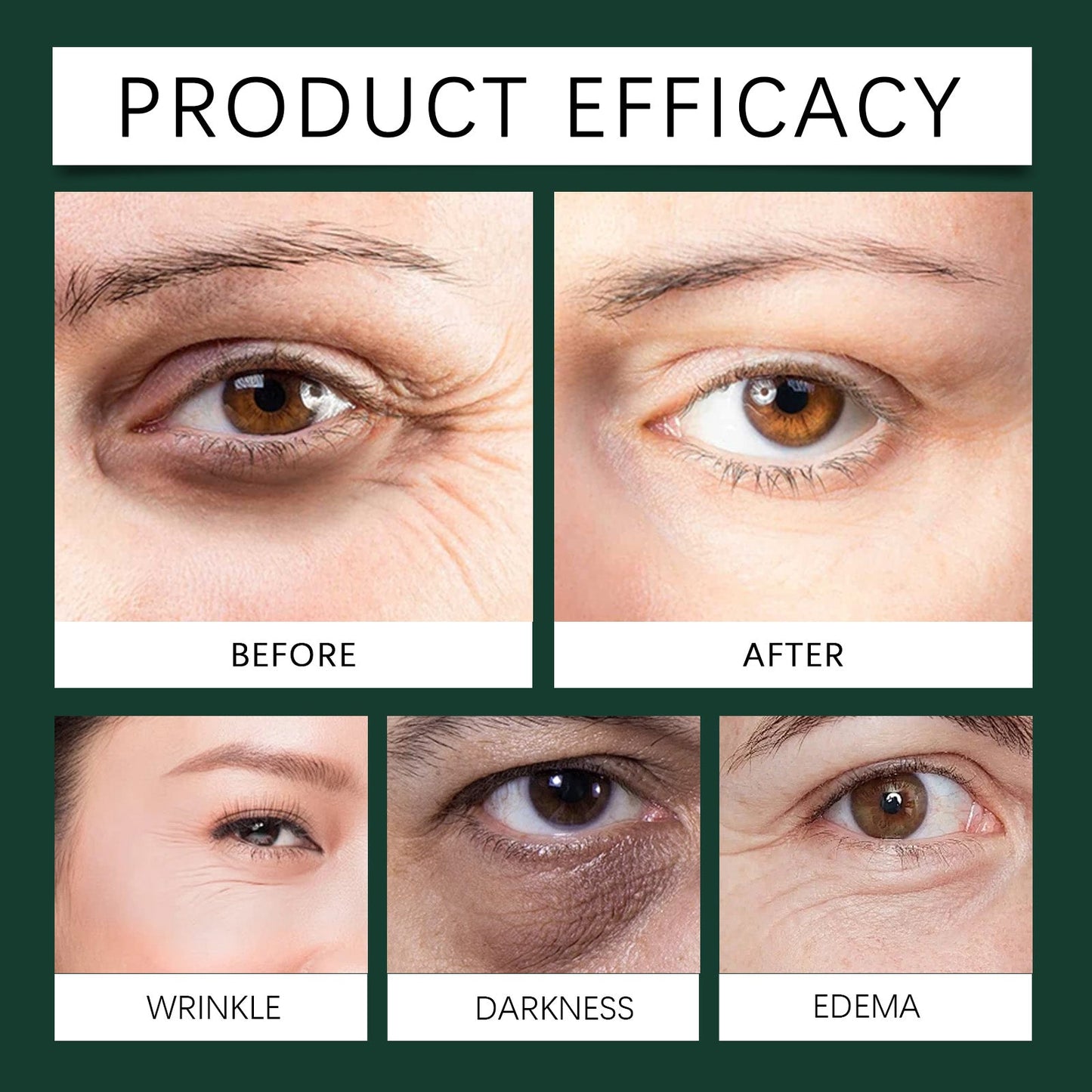 Mint Essence Eye Roller, Fade Fine Lines Crow's Feet Moisturizing Elastic Eye Anti-Wrinkle - Korvel
