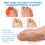 Thumb Toe Correction Patch, Big Toe Valgus Toe Swelling Correction Joint Pain Care Patch - Korvel