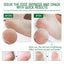 Chapped Heel Care Cream Repair Heel Peeling, Anti-Cracking And Moisturizing Foot Care Cream - Korvel