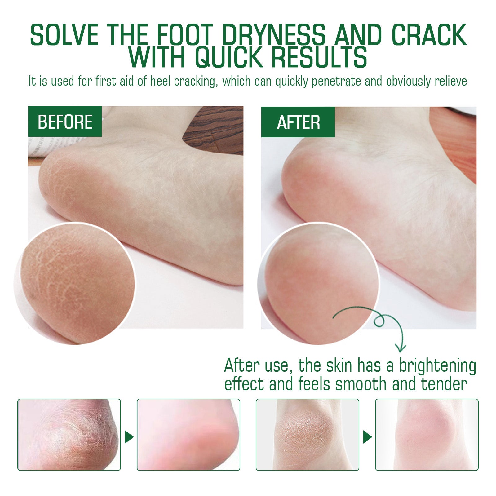 Chapped Heel Care Cream Repair Heel Peeling, Anti-Cracking And Moisturizing Foot Care Cream - Korvel