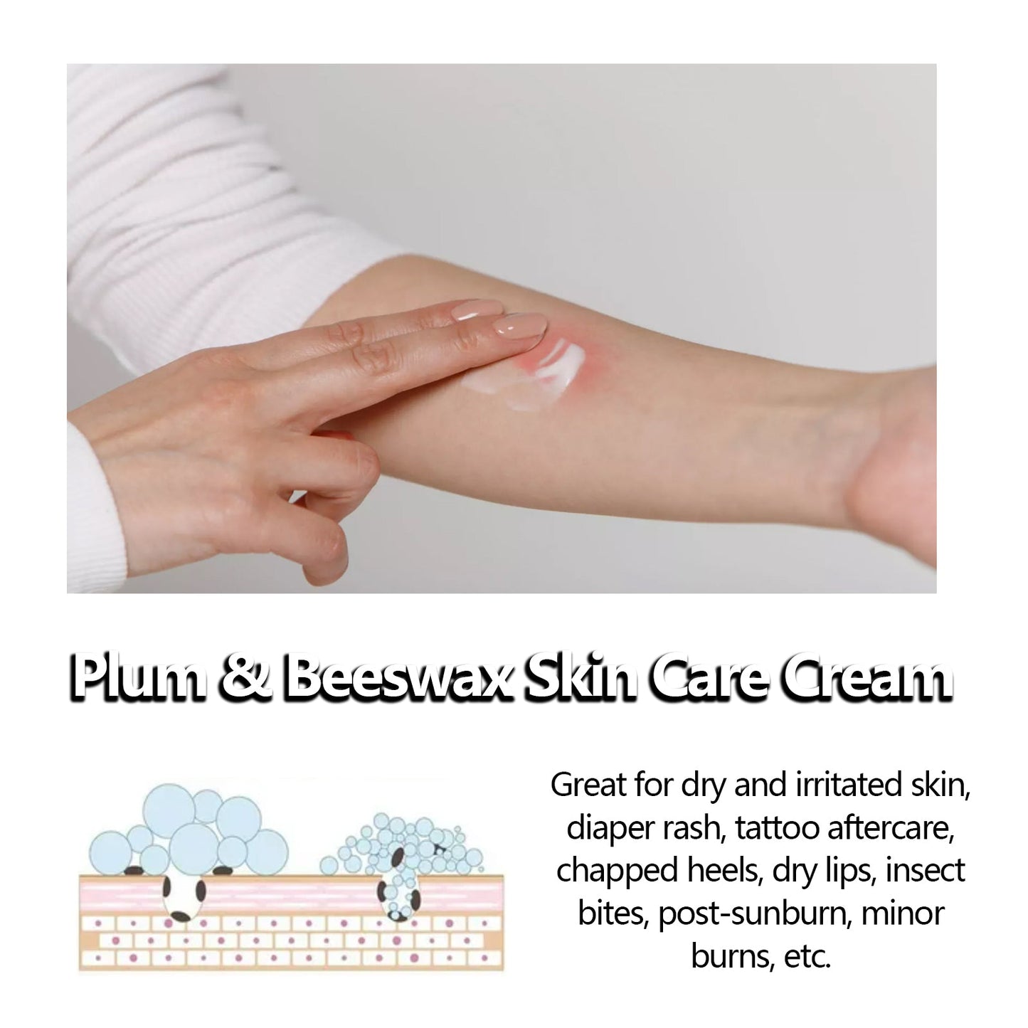 Beeswax Skin Cream Moisturizes Skin, Relieves Dry Skin, Sunburn, Mosquito Bites And Itch Relief Cream - Korvel