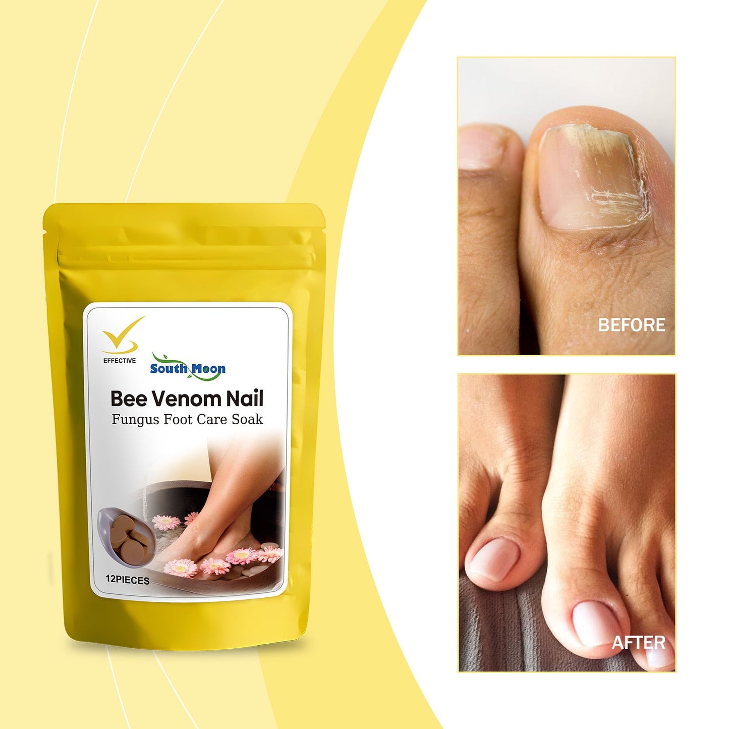 Nail Care Foot Soak, Gentle Cleaning Of Hands, Feet And Nails Moisturizing Soft Moisturizing Nail Face Foot Care - Korvel