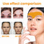 Anti-Aging Collagen Gel Patch - 10pcs Forehead Line Removal, Firming Mask, Frown Lines, Face Skin Care Stickers - Korvel