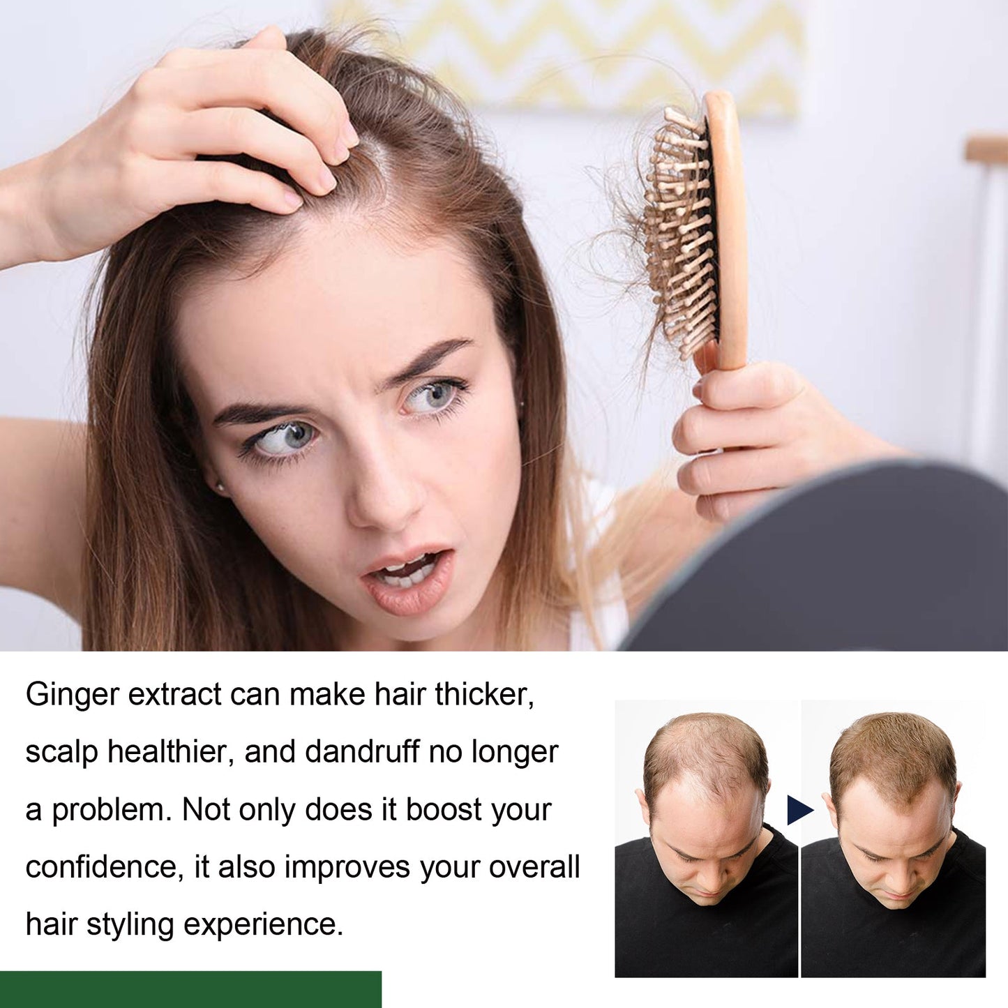 Ginger Hair Care Ball Scalp Care Nourishes Soft, Fluffy, Glossy Hair And Strengthens Hair - Korvel