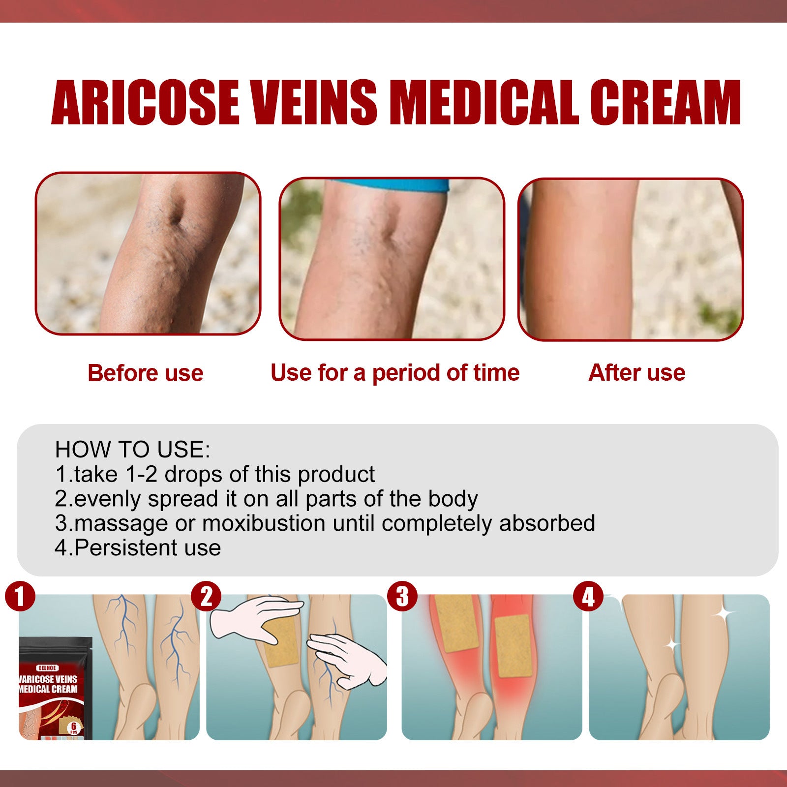 Aricose Veins Medical Cream, Relieve Leg Swelling Earthworm Leg Vein Massage To Relieve Pain - Korvel