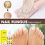 Herbal Antibacterial Nail Treatments Essential Oil, Grey Nail Care Essential Oil Brightening Nail Polish Clean Manicure Foot Care Solution - Korvel